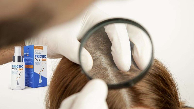 Learn about tricho mist forte opinie Learn about tricho mist forte opinie